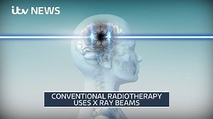 39K views · 1.3K reactions | A revolutionary cancer-fighting machine...