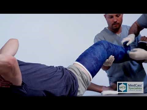 How to apply a LONG LEG CAST - Plus Cast Removal