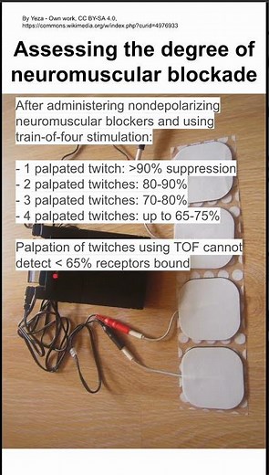 Assessing the degree of neuromuscular blockade