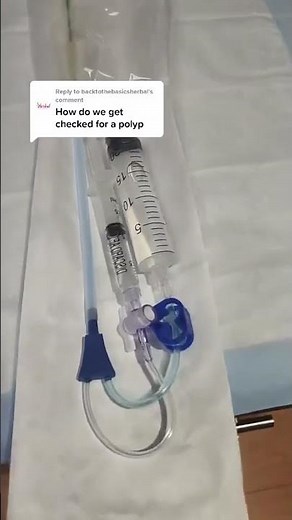 How do we diagnose uterine polyps? With sonohysterogram water ultrasound!