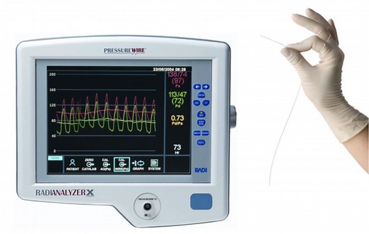 Fractional Flow Reserve (FFR) Study — SozoCardiology - Dr Ooi Yau Wei Interventional Cardiologist
