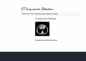 Lung Cancer Detection Using CNN