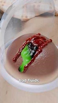 How This Suction Cup Therapy Works 🤔 Surgeon Reacts