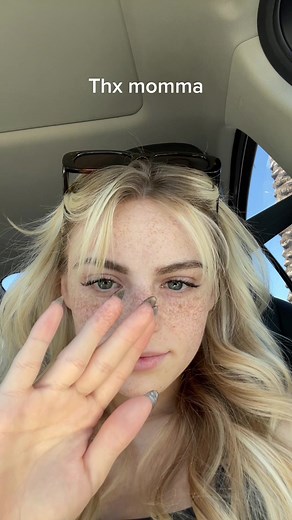 Real Natural Freckles and How to Get Them