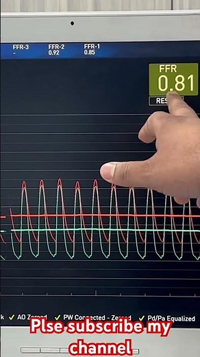How are the measurements done in FFR Procedure