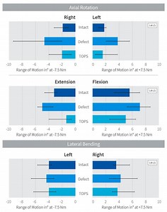 How TOPS™ System Works? | More Flexibility in the Treatment of Spinal Stenosis