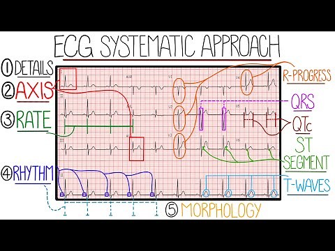 ECG Interpretation Made Easy (Learn How to Interpret an ECG in 13 Minutes)