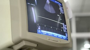 What is a CRT Monitor? | Features, Pros & Cons Explained