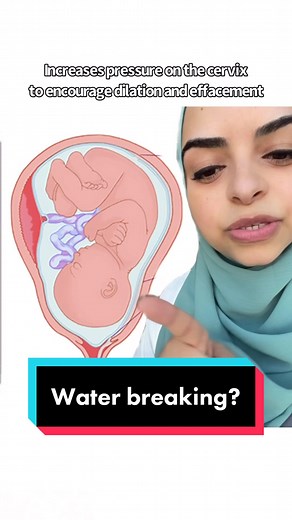Understanding the Process of Breaking Water during Pregnancy