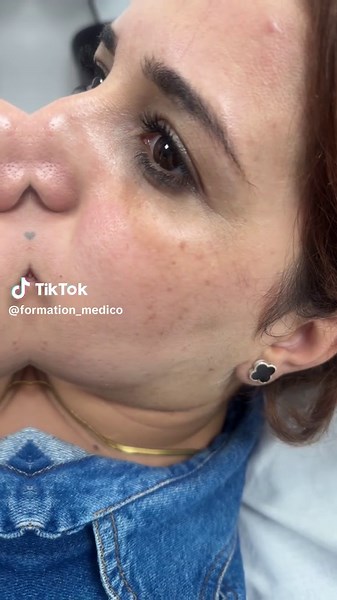 Vidéos de Formation_medico (@formation_medico) avec الصوت الأصلي - OLA YOUSEF