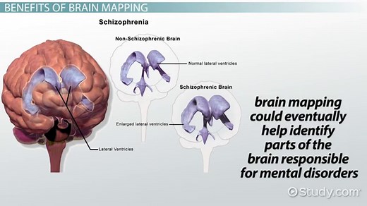 Brain Mapping | Test, Tools & Techniques