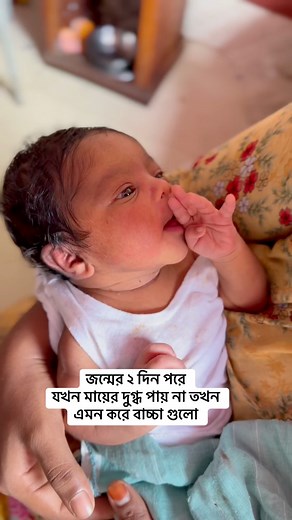 1.4M views · 34K reactions | Hungary newborn #baby #nicebaby #drataur #Queen | Dr. Ataur Rahman | Facebook