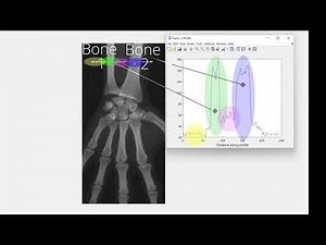 Matlab Thresholding, image segmentation, edge detection, image processing