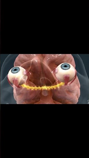 How the Eye Works and What Happens in Glaucoma