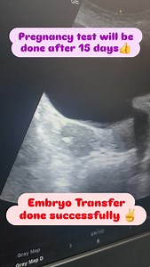 wish me luck IVF process procedure success hope real case scenario! 🤞 #IVF #success #hope #realcase | Dr Shivani Mishra Hardoi official