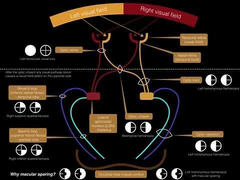 Visual Pathway & Visual Field Defects - Dr. MDM