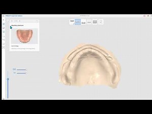 Full Denture Scan (ENG)