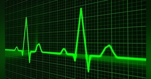 Encoders: the pulse of motion