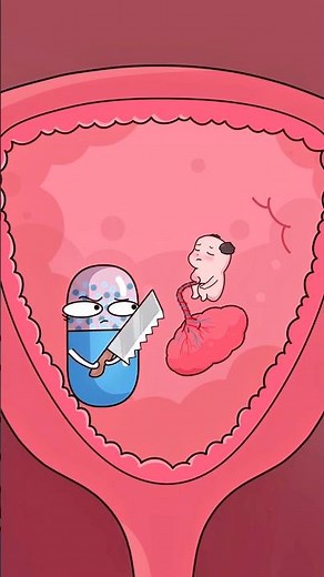 How the Abortion Pill Actually Works 💊😱..!!#e2dhealth #animation #2dshow #shorts #comedy