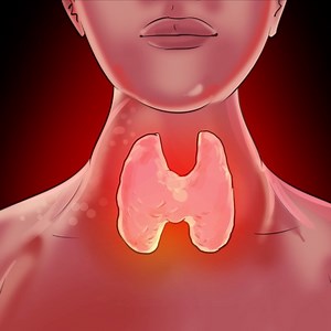 262K views · 529 reactions | Early signs of thyroid problems | DEMIC | Facebook