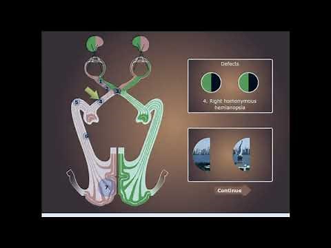 visual pathway and Visual Field Defects
