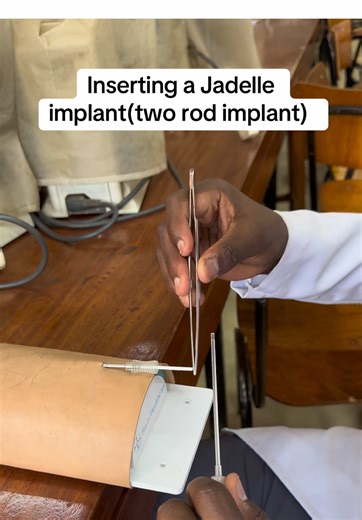 How to insert a Jadelle implant. Get to learn these skills. #drnathanrono #medicine #medicalstudent