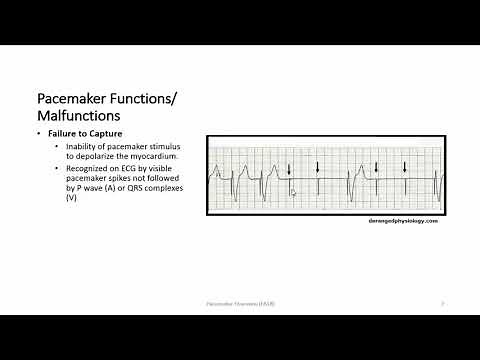Pacemaker Overview