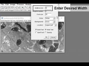 Electron Microscopy Images: Post-processing steps in Image J