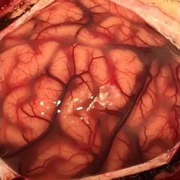 The Human Brain - Alive!