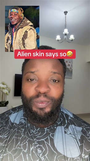 Alien Skin: Discover the Trendy Look!